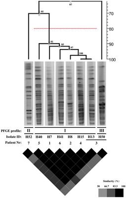 Intra- and Extra-Hospital Dissemination of IMP-22-Producing Klebsiella pneumoniae in Northern Portugal: The Breach of the Hospital Frontier Toward the Community